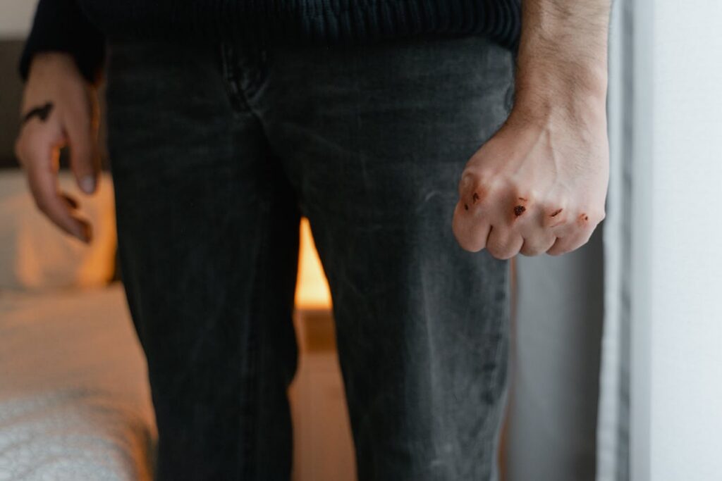wounds on a person's knuckles